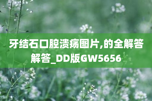 牙结石口腔溃疡图片,的全解答解答_DD版GW5656